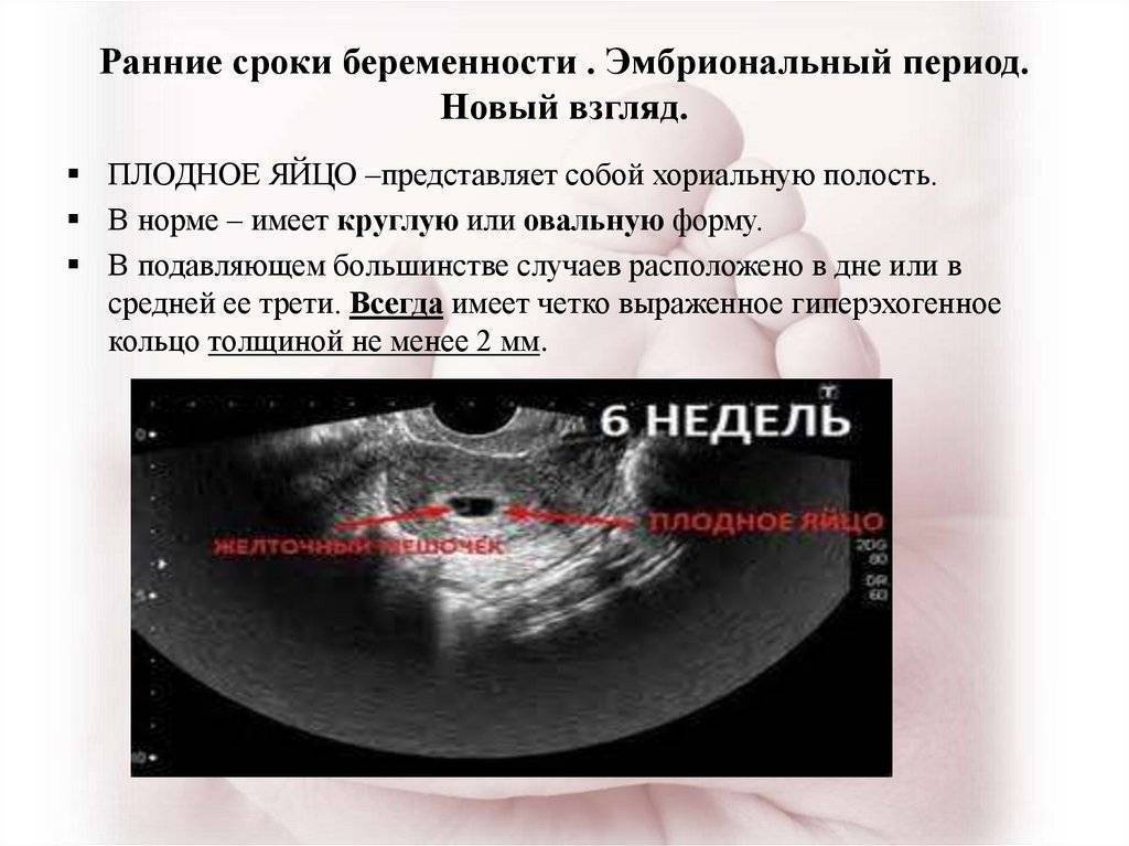 Неразвивающаяся беременность: причины, патогенез, симптомы, последствия, лечение | клиника "центр эко" в москве