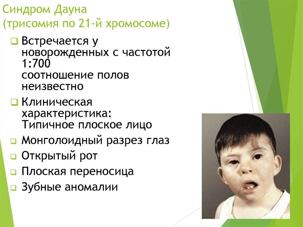 Вечные дети. как построить отношения с ребенком,у которого синдромом дауна? | культура | аиф новосибирск
