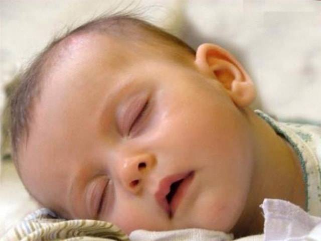Себорея на голове у ребенка: причины, лечение, шампунь
