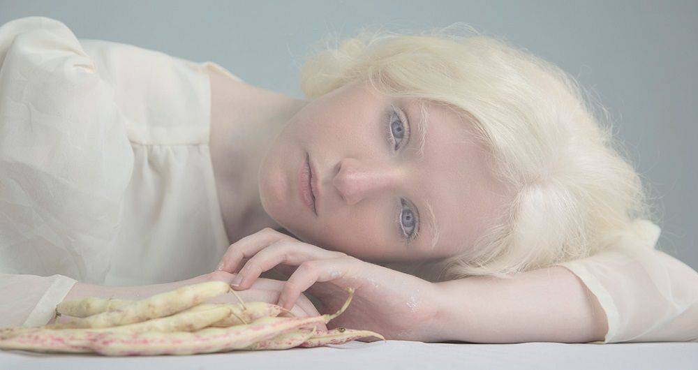 Альбинизм у человека - причины возникновения и как наследуется | люди - альбиносы