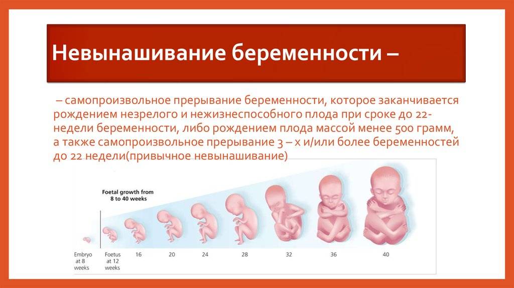 Замершая беременность: симптомы, сроки, причины