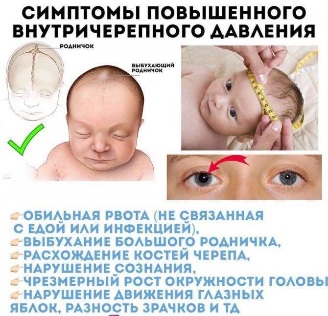 Голова ребёнка. изменение формы