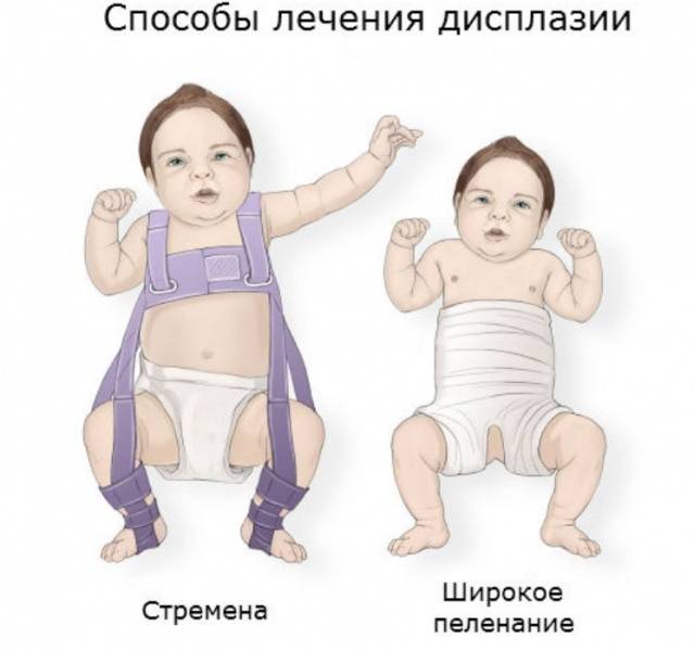 Про ядра окостенения тазобедренных суставов у детей. - beautyvertebro.com