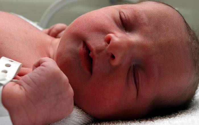 Почему новорожденный ребенок синеет после родов. синеет носогубный треугольник у грудничка: что делать и с чем это связано? заболевание органов дыхания