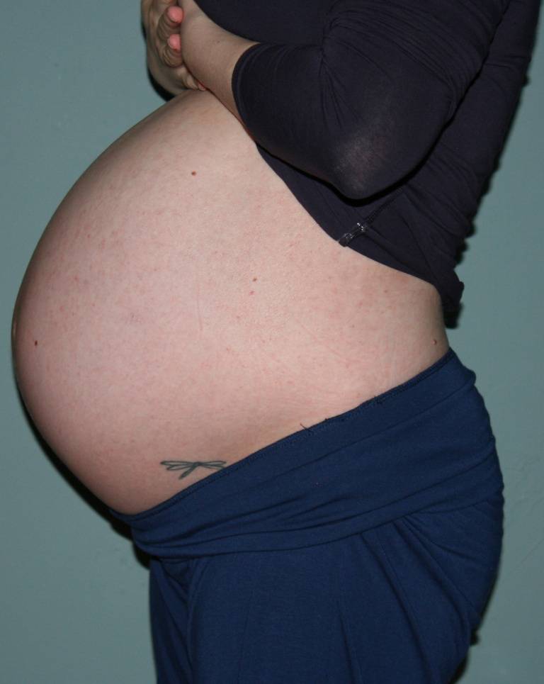 Орви и беременность. – клиника «9 месяцев»
