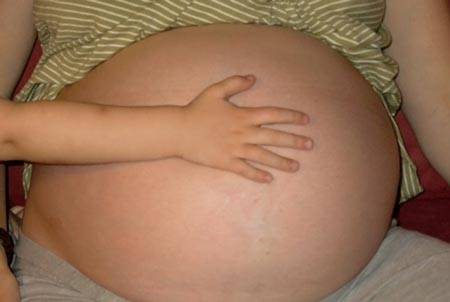 Головные боли при беременности – клиника «9 месяцев»