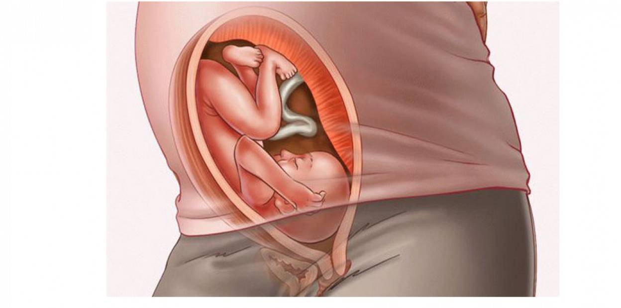 27 недель болит живот. Расположение плода на 29 неделе беременности. Малыш на 29 неделе беременности в животе. Расположение ребенка на 28 неделе беременности. Расположение ребенка на 29 неделе беременности.
