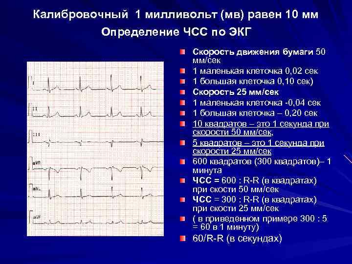 Расшифровка кардиограммы онлайн по фото бесплатно