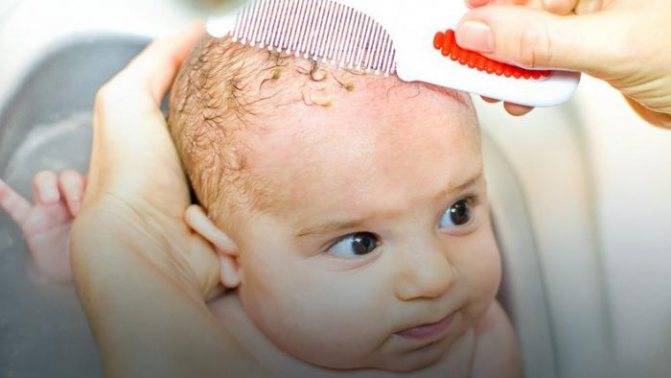 Корочка на голове у младенца | как удалить дома и нужен ли врач