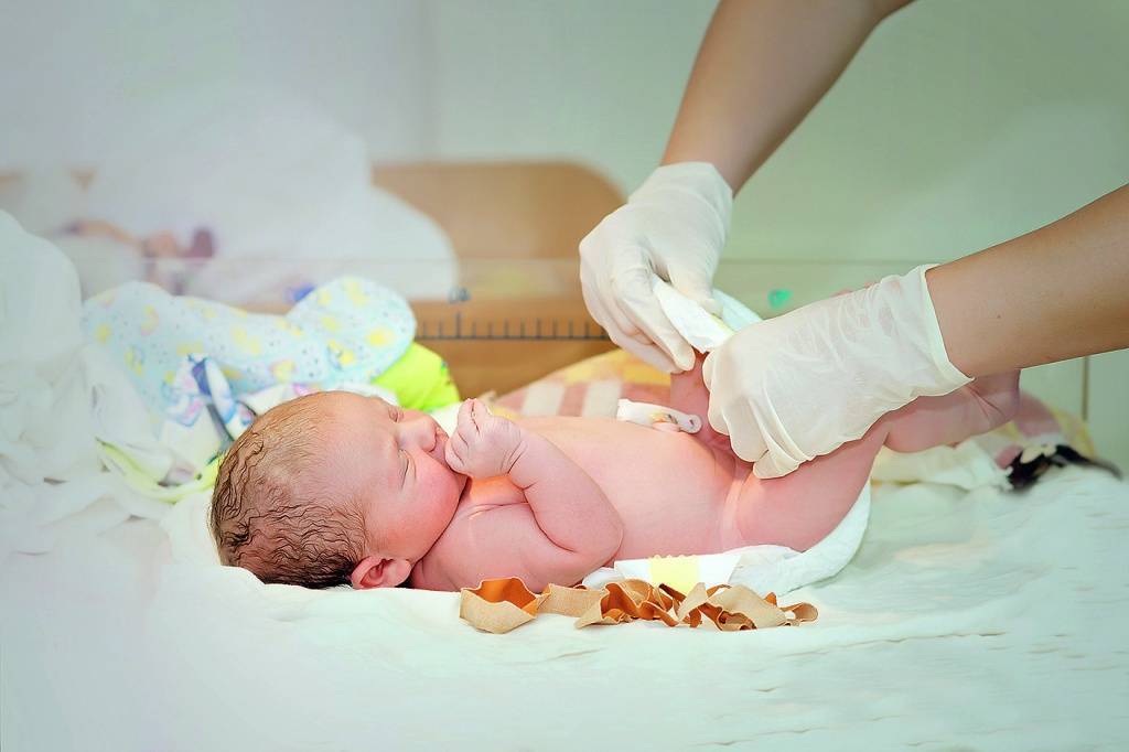Важные рекомендации: как обрабатывать пупок новорожденного