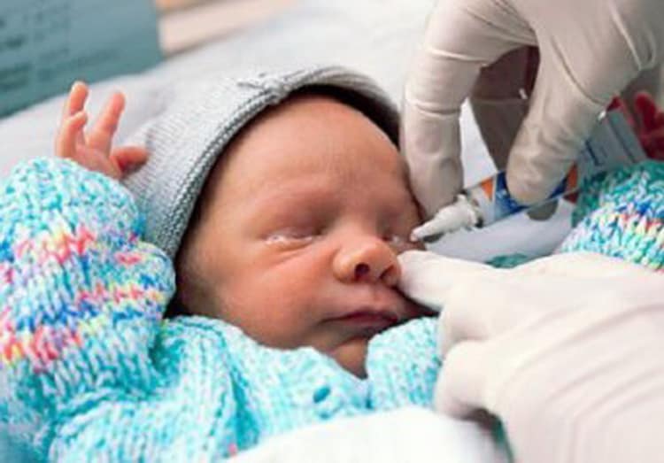 Птоз верхнего века у новорожденных: причины и лечение