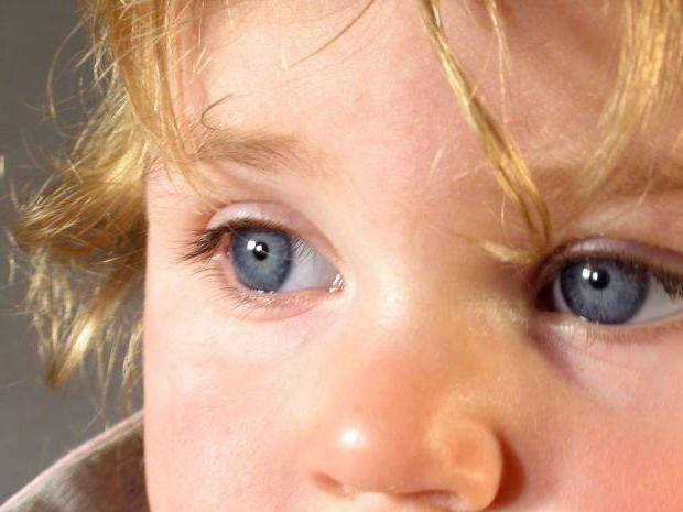 Проблемы с глазами у малышей — это очень серьёзно! что такое ангиопатия сетчатки у грудничка