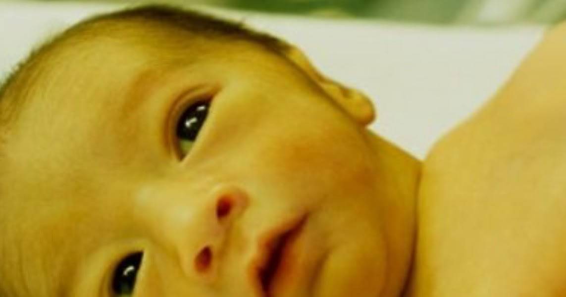 Детская желтушка (желтуха) у новорожденных лечение | fortis