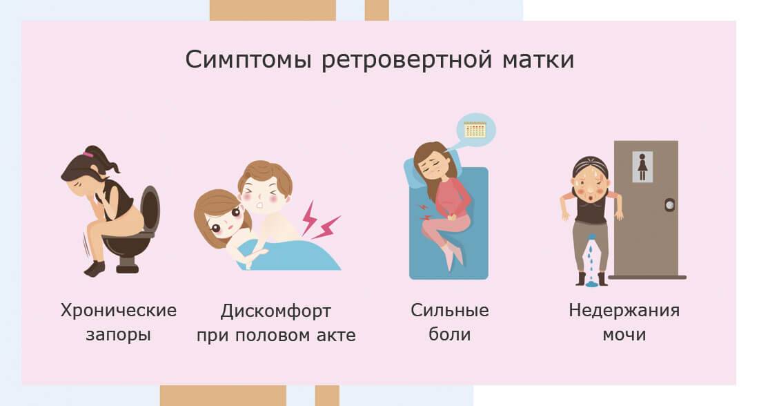 Как забеременеть при загибе матки: кпереди, кзади, влево, вправо - зачатие на ранних сроках