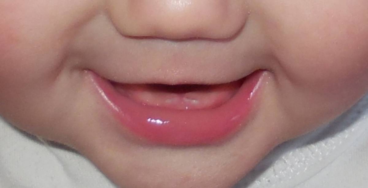 Какие зубы лезут первыми у ребенка — схема