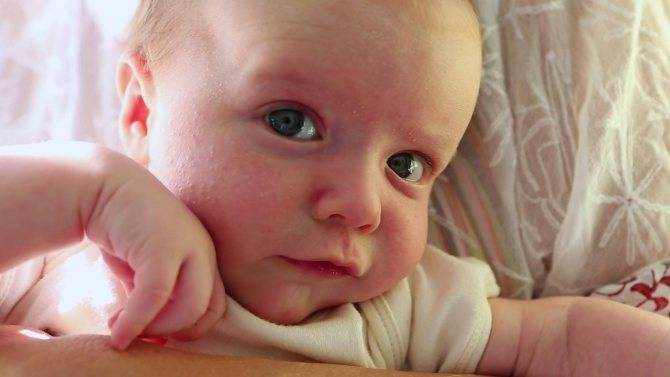Тремор у новорожденных: причины, последствия комаровский
