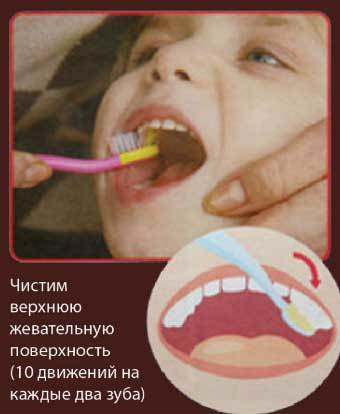 Прорезывание коренных зубов у детей - симптомы, как режутся коренные зубы
