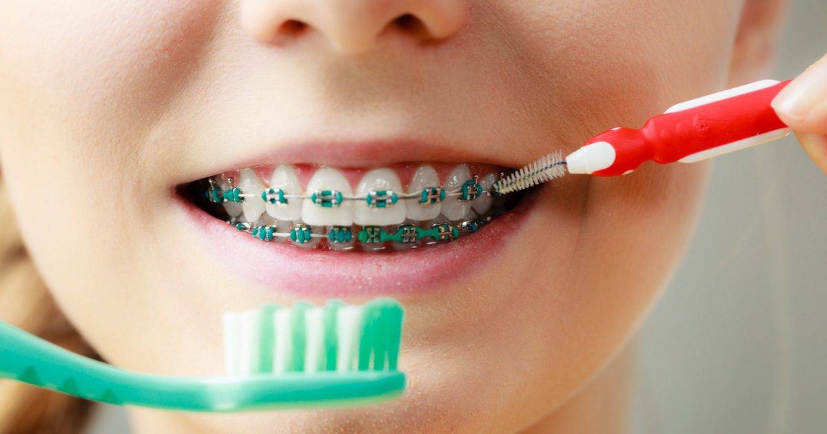 Больно ли вставлять зуб: имплантация, коронка, последствия и реабилитация