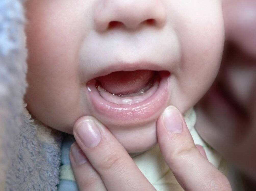 Когда начинают расти и во сколько режутся зубы у новорождённого
