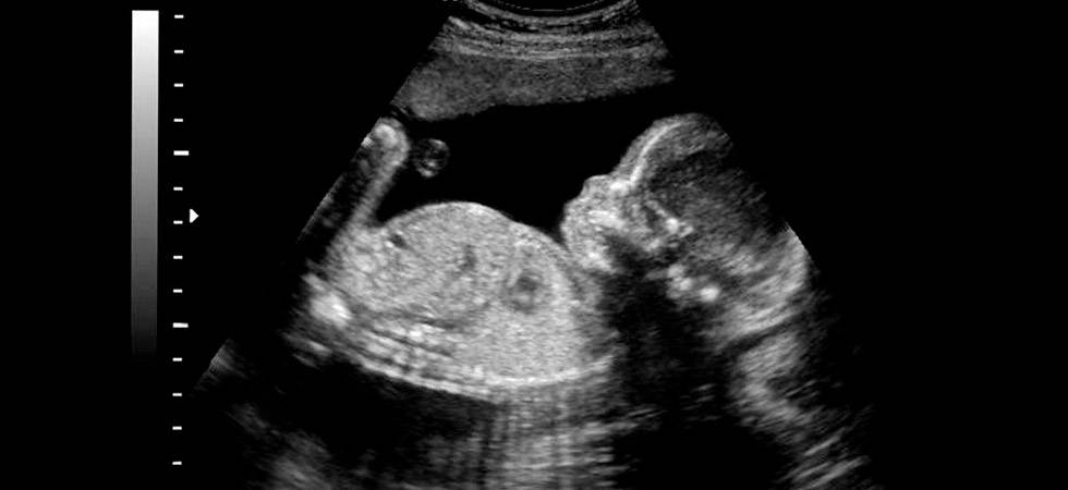 Узи в 22 недели беременности: норма, расшифровка показателей