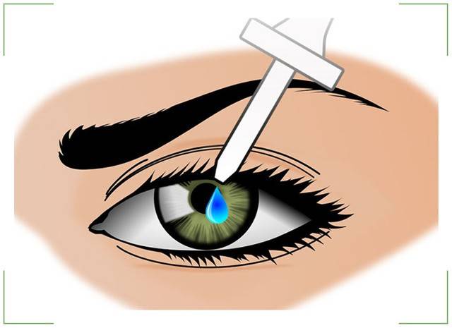 Профилактика катаракты - надежные способы предотвращения недуга