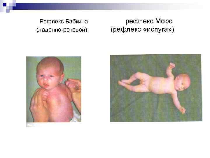 Таблицы по педиатрии - файл 1-рефлексы.doc