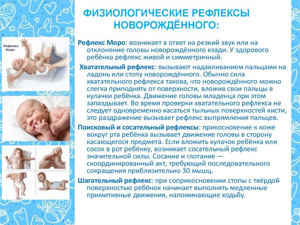 Эффект моро у младенцев до какого возраста ~ детская городская поликлиника №1 г. магнитогорска