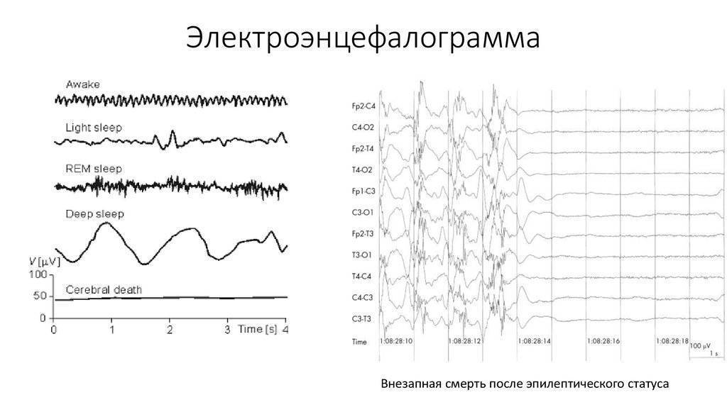 Консультация эпилептолога в москве | цены на консультацию нейропсихологических заболеваний и отклонений у детей в epihelp
