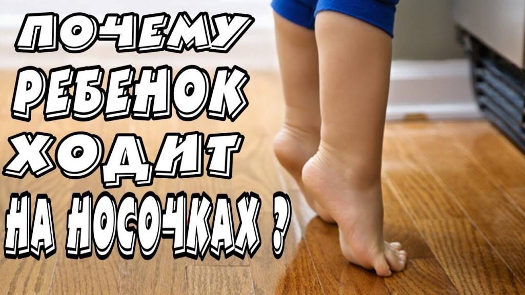 Ребенок ходит на носочках (на цыпочках): причины, что делать родителям