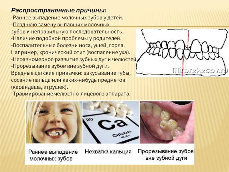 Молочные зубы у детей: схема выпадения и замены на коренные