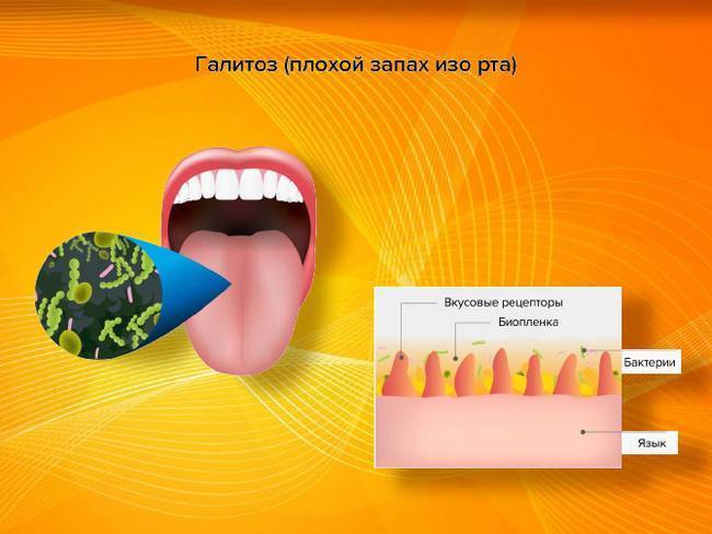 Что делать, если у ребёнка неприятный запах изо рта | детская стоматология shifa