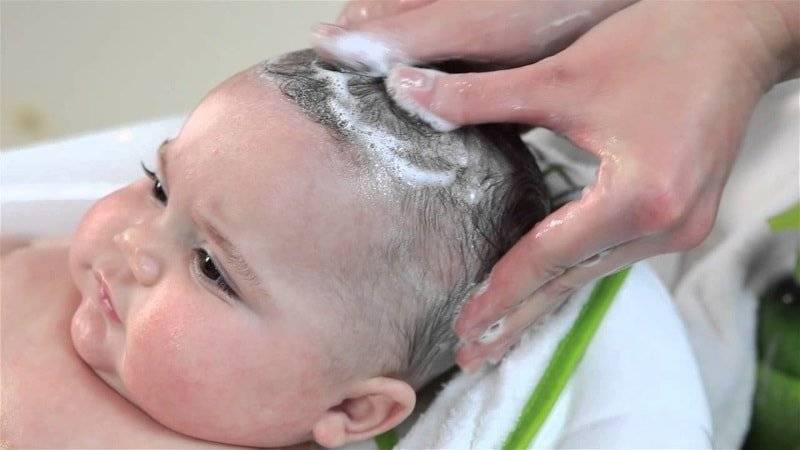 Молочные корочки: как ухаживать за кожей головы новорожденного - parents.ru