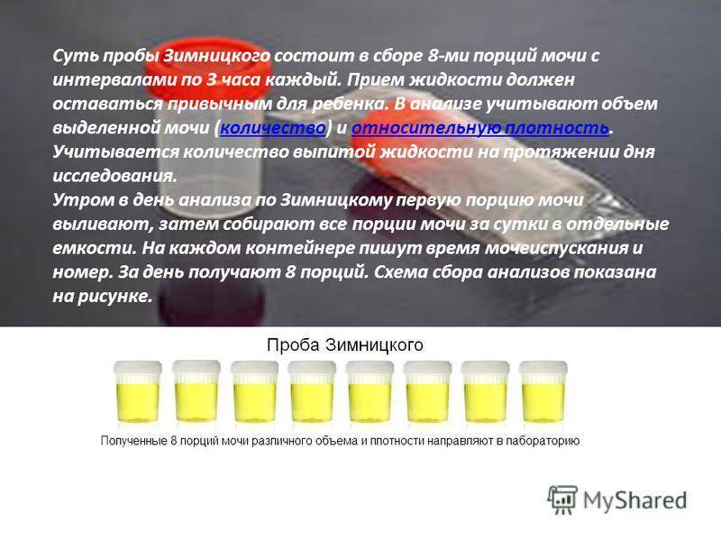 Сколько достаточно мочи для анализа грудничка ~ детская городская поликлиника №1 г. магнитогорска