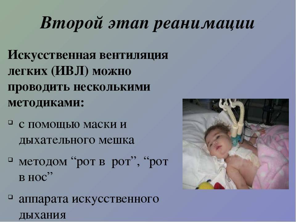 Реанимация новорождённых и интенсивная терапия новорожденных в москве - клиника «мать и дитя»