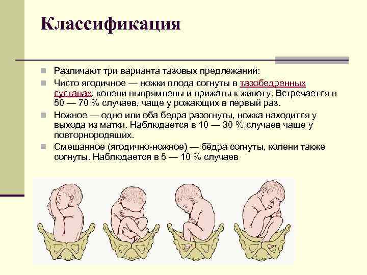 Тазовое предлежание плода: классификация, особенности, причины, ведение беременности и способы родов