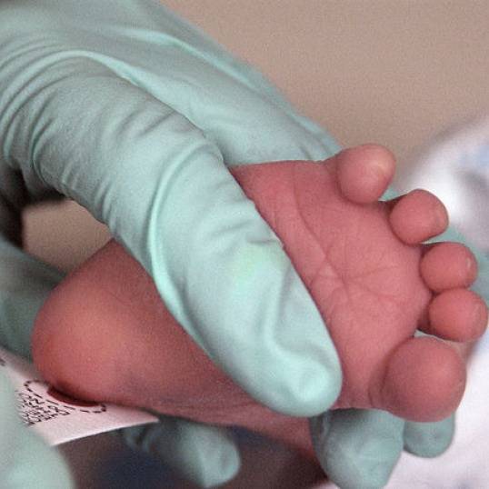 Желтуха у новорожденного – о симптомах, диагностике, лечении рассказывает педиатр-неонатолог клиники  isida