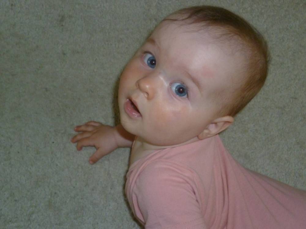 Почему у ребенка синяя переносица — причины появления синих венок
