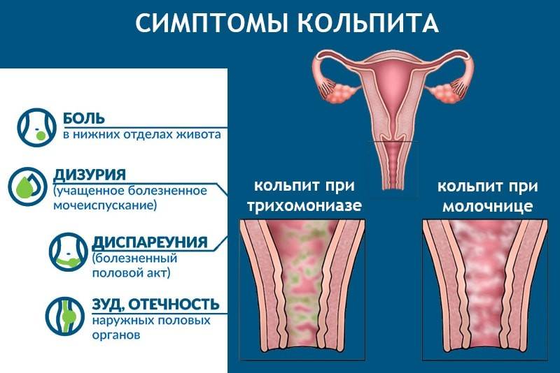 Кольпит при беременности: что это, последствия для ребенка, симптомы и лечение — медицинский женский центр в москве