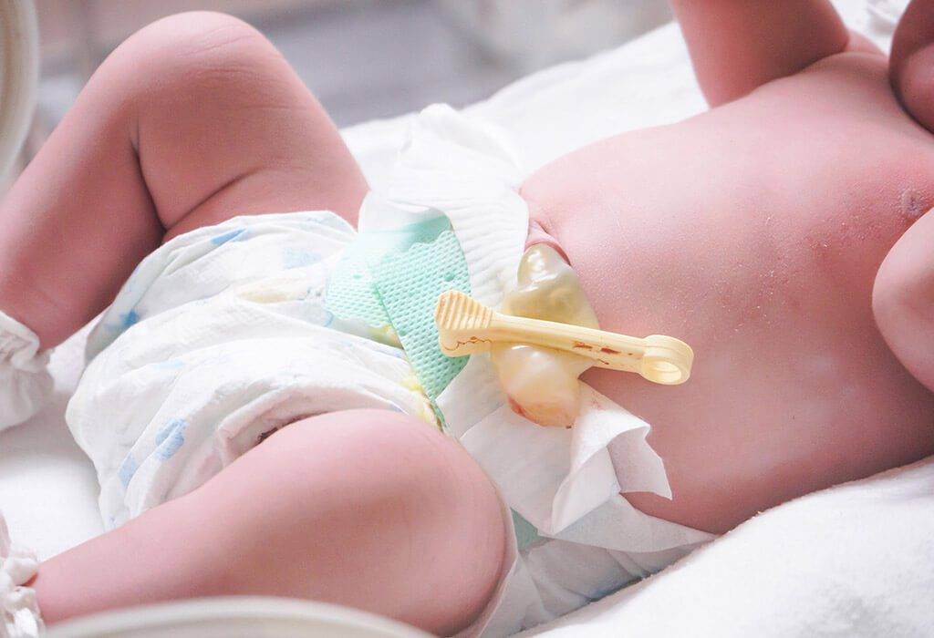 Важные рекомендации: как обрабатывать пупок новорожденного - для мам