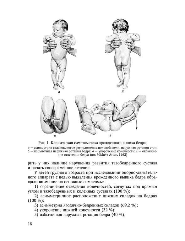 Норма тазобедренного сустава у грудничков, признаки и лечение дисплазии
