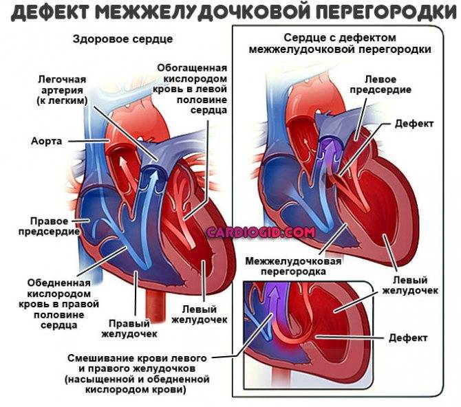 Диагностика и лечение пороков сердца у детей (сергиев посад)