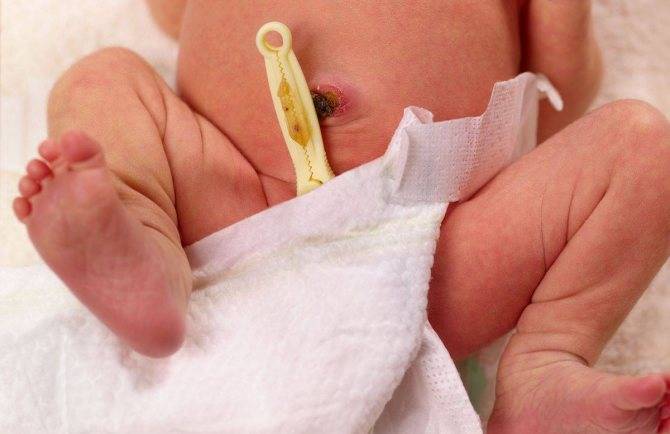 Как обрабатывать пупок новорожденного: современные рекомендации