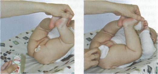 Варикоцеле у детей: симптомы у новорожденных мальчиков, нужно ли лечить ребенка