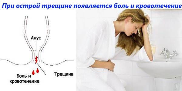 Инородное тело в кишечнике. лечение: извлечение из кишечника инородных предметов.
