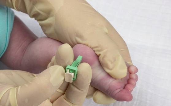 Желтуха у новорожденного – о симптомах, диагностике, лечении рассказывает педиатр-неонатолог клиники  isida