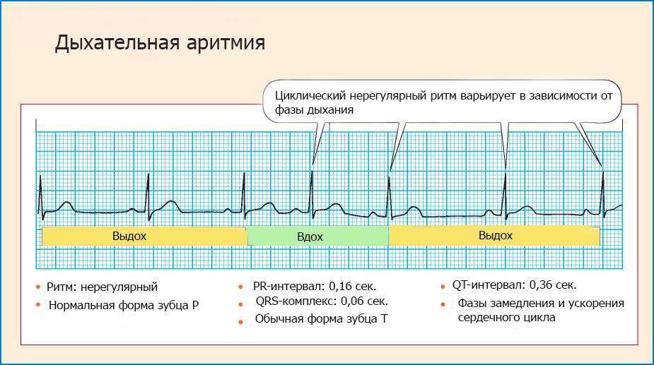 Детский кардиолог в новосибирске | цены, отзывы, врачи, записаться на консультацию в «сердолик»