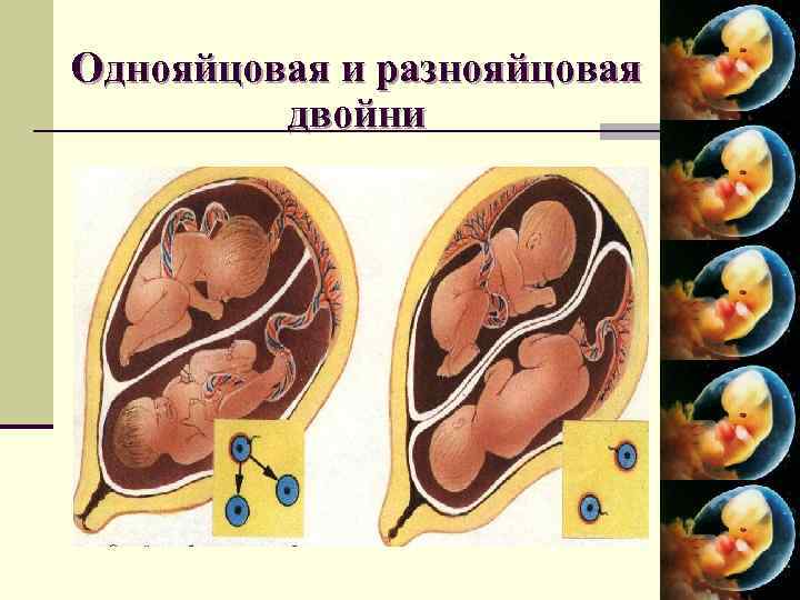 Двойная беременность – симптомы, узи, роды