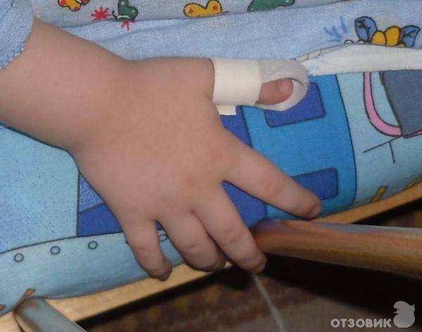 Ребенок сосет палец: как отучить, лучшие способы и причины