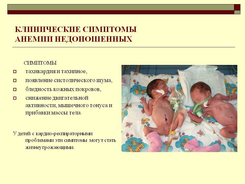 Анемия у детей. признаки и лечение