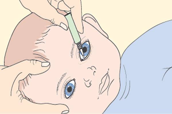 Как промывать глаза при конъюнктивите заваркой